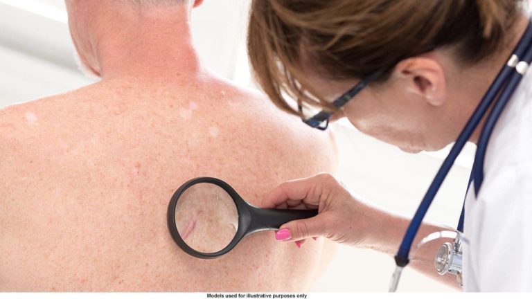 The Cancer You’ve Never Heard of … Is Common and Can Be Dangerous