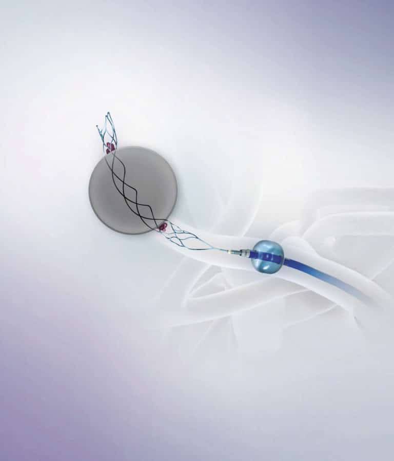 A first: New guidelines back device for treating strokes