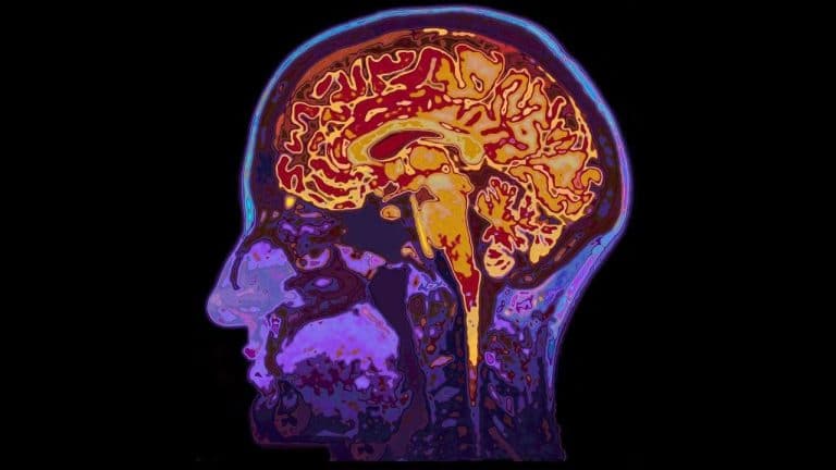 Decoding brain injury